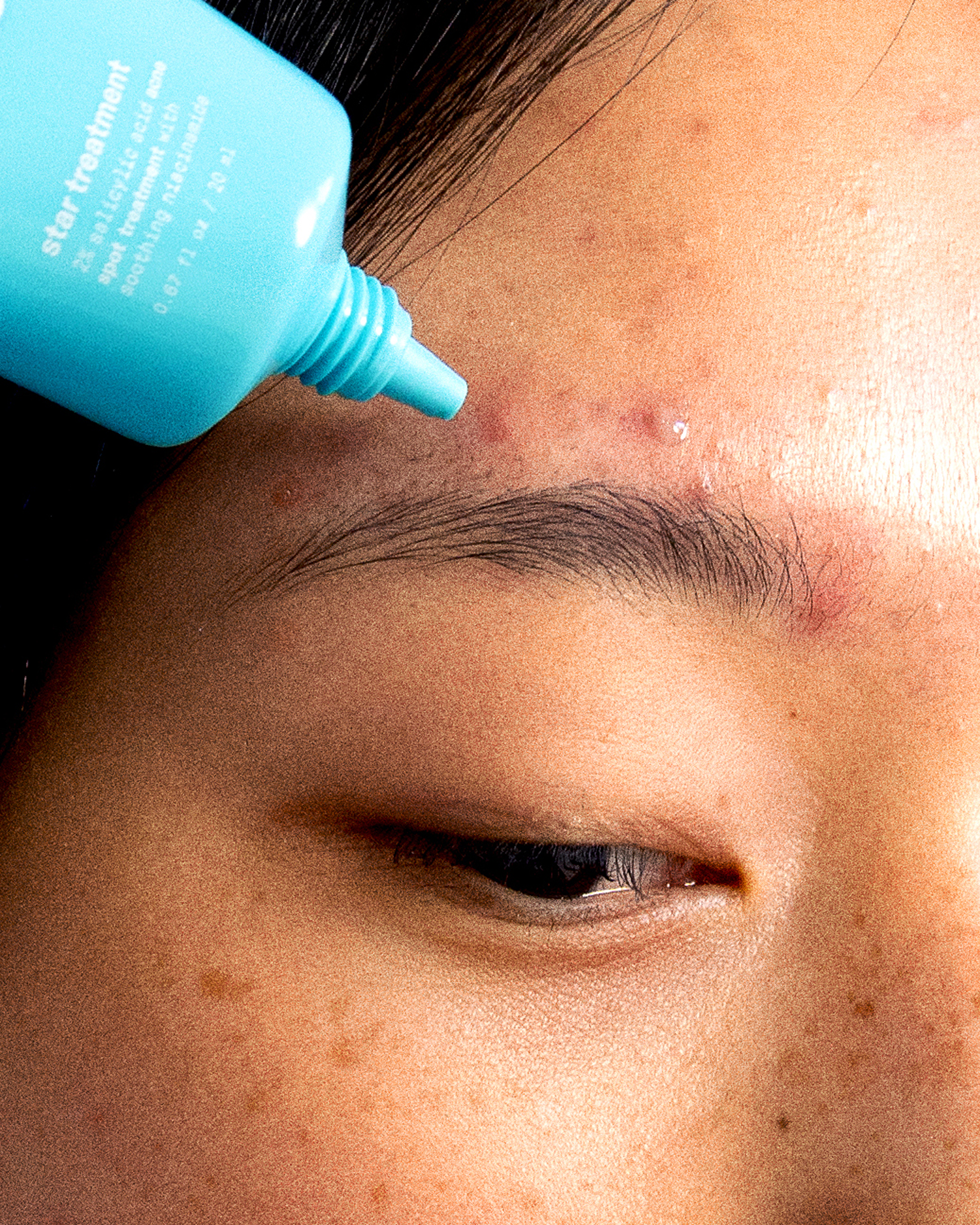 star treatment™ + hydro-star® clear bundle - Smooth Look On The Go Patches